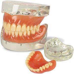 dental model